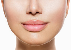 Juvederm